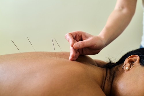 Maigrir acupuncture Geneve